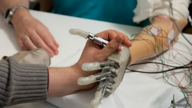 біонічна рука