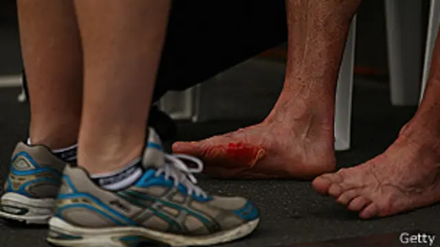 Realmente los zapatos para correr previenen lesiones BBC News Mundo