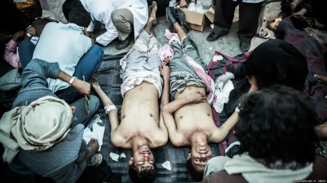 18 مارس 2011: متظاهران فاقدا الوعي بعد احداث ما سمي "بمجزرة جمعة الكرامة". عبد الرحمن جابر