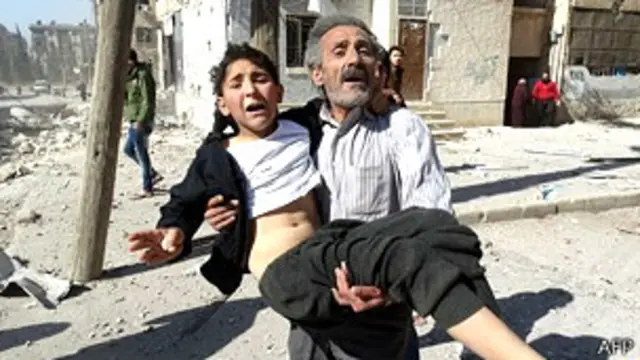 叙利亚受伤民众