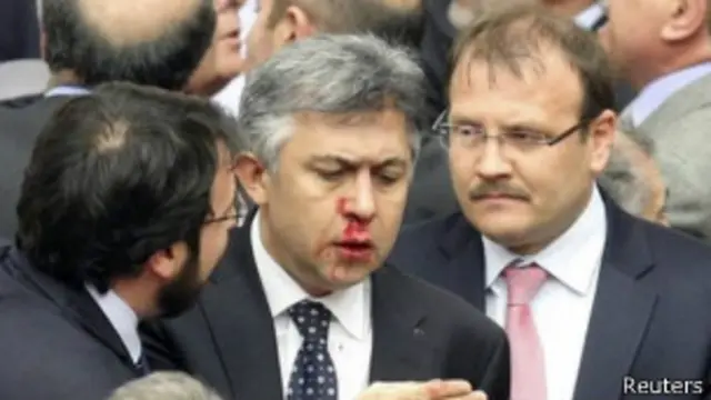 أصيب البرلماني المعارض علي إحسان كوكترك بكسر في أنفه واضطر لتلقي العلاج في المستشفى