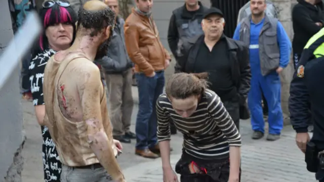 بعض جرحى انفجار أنبوب الغاز الذي أصيب فيه أربعة أشخاص ونقلوا إلى مستشفى قريب. 