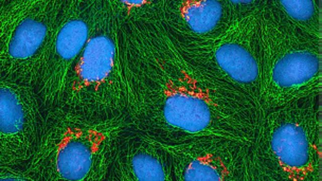 بينت نتائج الدراسة أن السرطان ليس مرضاً عصرياً
