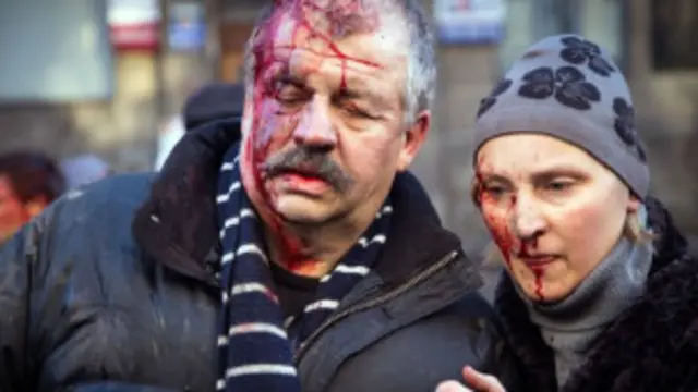  د کییف په وروستیو بریدونو کې سلګونه تنه ټپي شوي دي