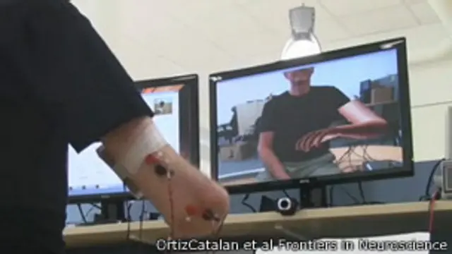 Terapia con realidad aumentada