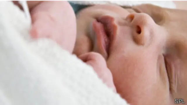 نسبة احتمالات ظهور السمنة بين الأشخاص الذين ولدوا قيصريا كانت أعلى بنحو 22 في المئة.