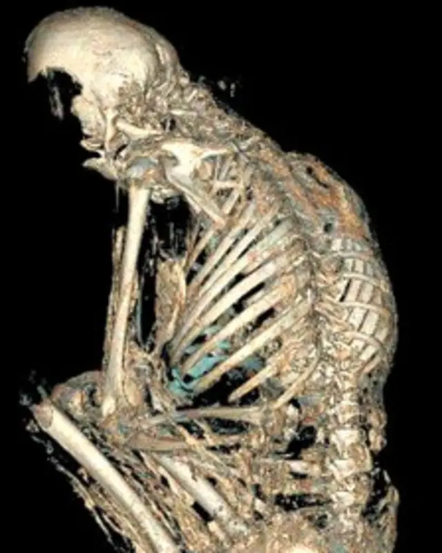 Reconstrucción del cráneo de la momia de una joven sudamericana