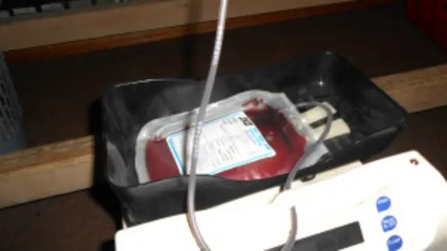 اړمنو کسانو ته د وينې ورکړه دومره دود نه وه خو اوس ډېری ځوانان د وينې ورکړې ته چمتو دي