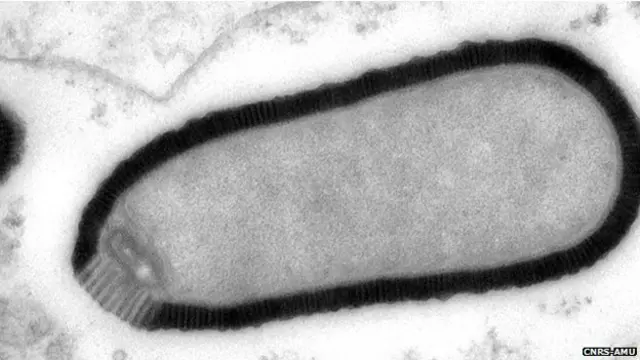 پائتھووائرس نامی اس جرثومے کی لمبائی ڈیڑھ مائیکرومیٹر ہے اور یہ اب تک پایا جانے والا سب سے بڑا وائرس ہے