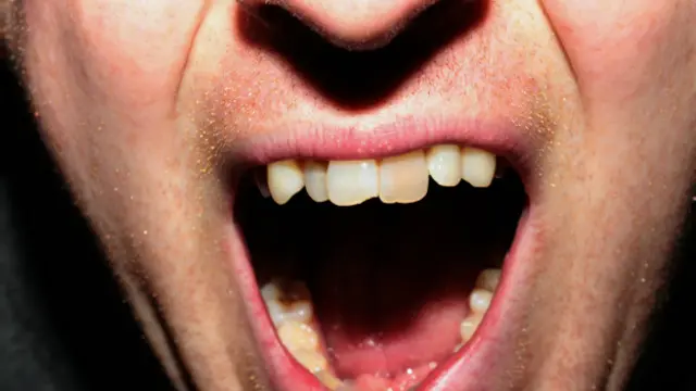 Ataque de raiva | Crédito: BBC