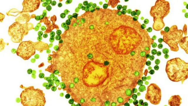 استخدام الجين يتم بتنقية الدم من الخلايا المصابة، ونقل الجين المضاد للفيروس إلى الدم ثم أعادته للمريض من جديد.