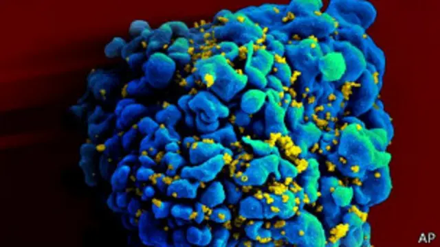 一种让女性在性生活之后使用的凝胶，能进一步防止艾滋病毒HIV的感染。