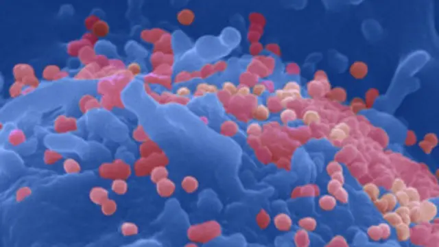 ویروس اچ آی وی 