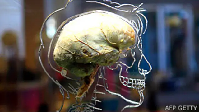Modelo de un cerebro en un esqueleto transparente, en una exhibición en Bristol, Inglaterra