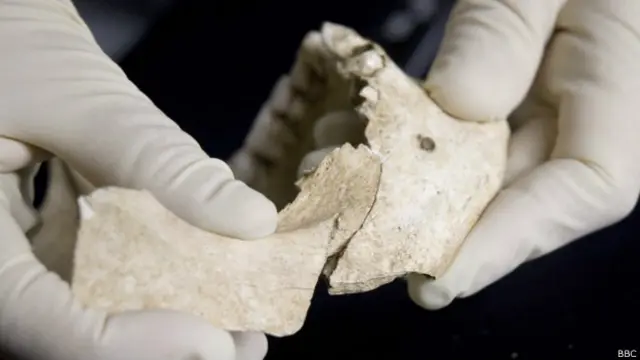 Bekas potongan pada rahang salah-seorang korban.