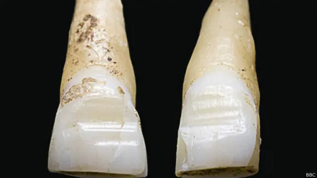 Sebagian korban memiliki gigi yang sudah 'ditata'. Kemungkinan menunjukan status sosialnya. 