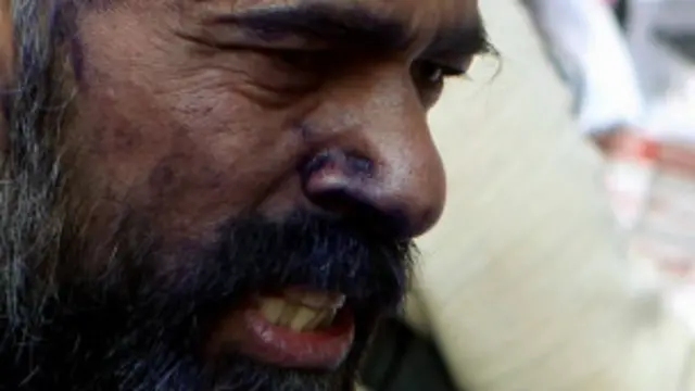 حال میں یوگیندر یادو کے چہرے پر روشنائی سے حملہ کیا گيا تھا