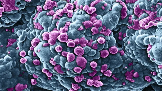 மார்பகப் புற்றுநோய் செல்கள் மிக நுண்ணிய அளவிலான மருந்தேற்றிகள் மூலம் சிகிச்சைக்குள்ளாவதைக் காட்டும் படம் 