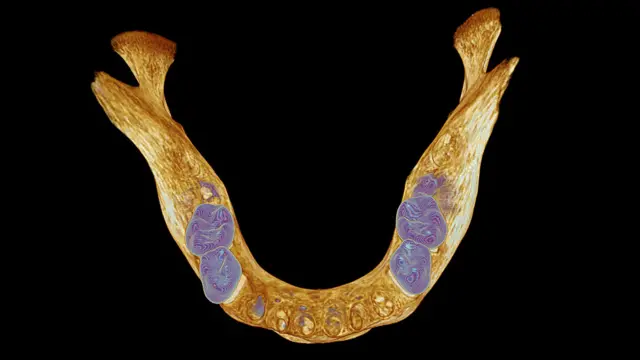 அடித்தாடை எலும்பு 