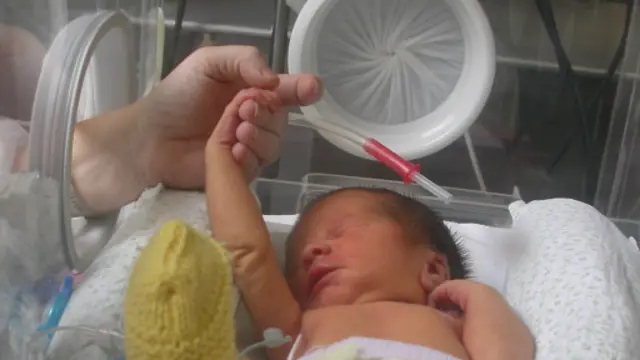 Bebê prematuro (BBC Brasil)