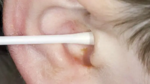 قد يحتوي شمع الاذن على مواد سامة لا تظهر إلا بتحليل الدم 