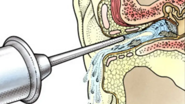 Las células del canal auditivo son únicas porque pueden migrar. 