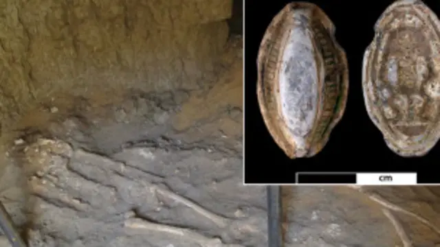 'புற்றுநோய் 3,000 ஆண்டுகளுக்கு முன்னரே இருந்தது'