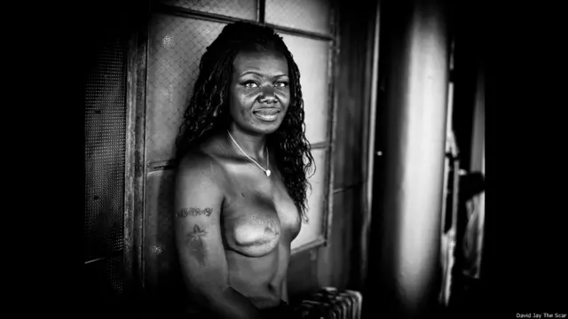 David Jay, proyecto fotográfico sobre cicatrices The Scar