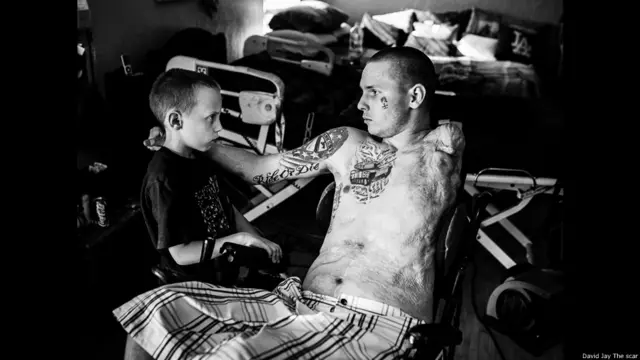 David Jay, proyecto fotográfico sobre cicatrices The Scar