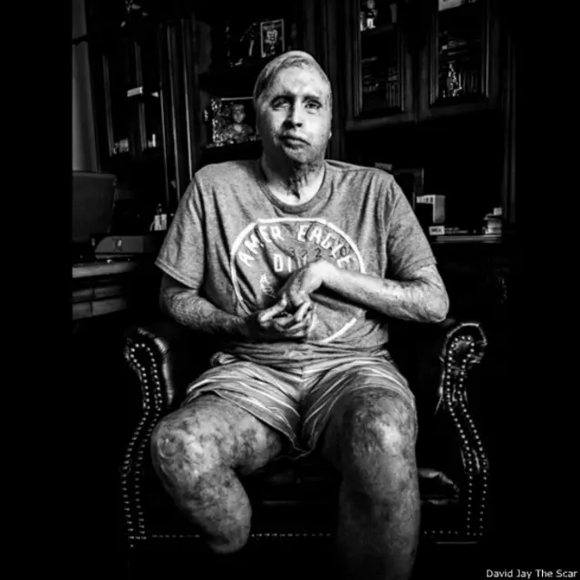 David Jay, proyecto fotográfico sobre cicatrices The Scar