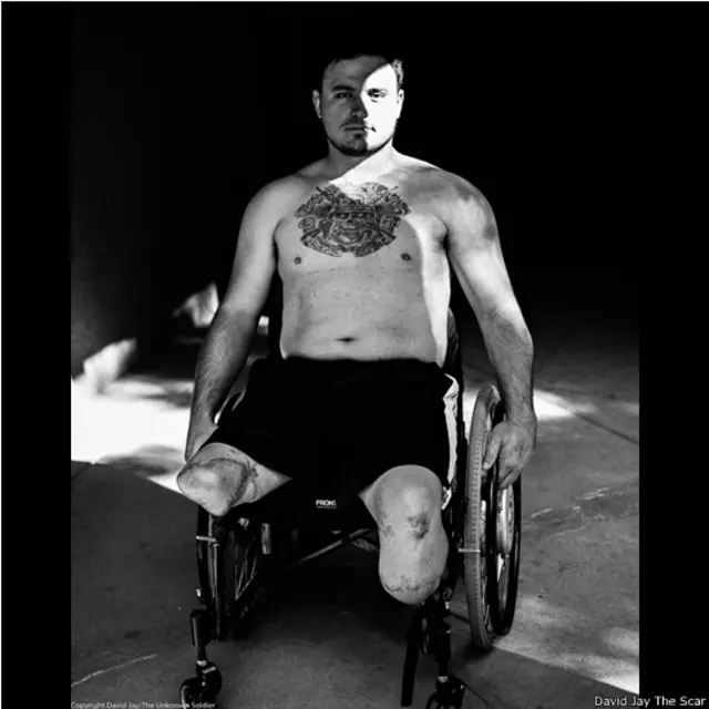 David Jay, proyecto fotográfico sobre cicatrices The Scar