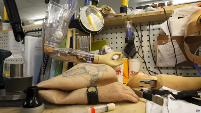 कृत्रिम अंग