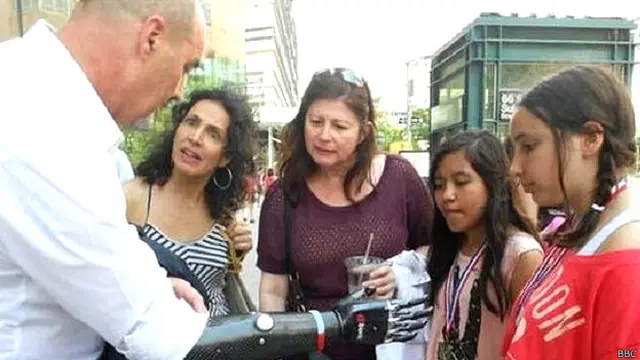 कृत्रिम अंग