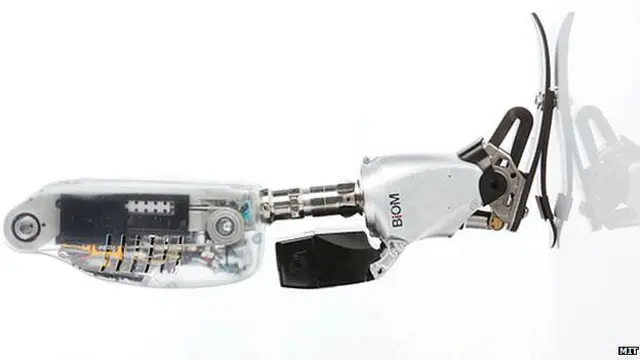 कृत्रिम अंग