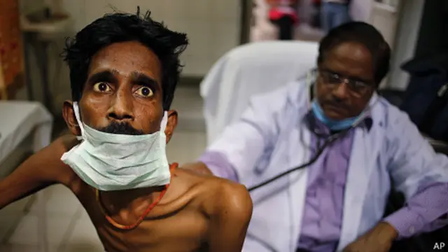 Paciente con tuberculosis