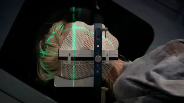 Hallenga fez radioterapia para tratar um tumor no cérebro