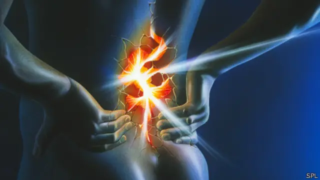 Ilustración de dolor de espalda