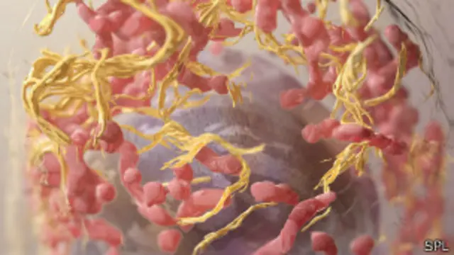 يتوقف خطر الإصابة بأورام الميلانوما السرطانية على عدة عوامل، من بينها التعرض للشمس، ونوع الجلد، والتاريخ الوراثي للعائلة.