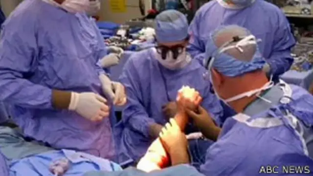 Operación de Lindsay Ess