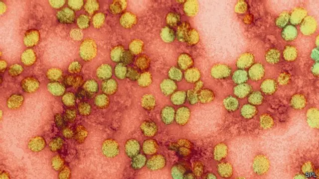 Virus de la fiebre amarilla