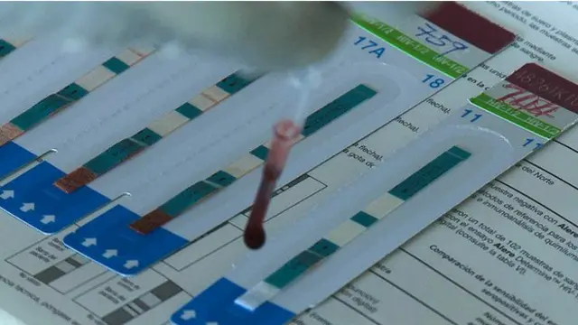 युगांडा में फर्जी एचआईवी सर्टिफिकेट