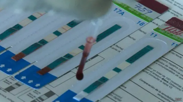 لا توجد أي قوانين لحماية الأشخاص المصابين بالفيروس من التمييز في أوغندا