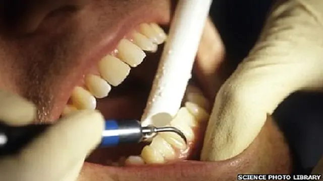 दांतों की जांच