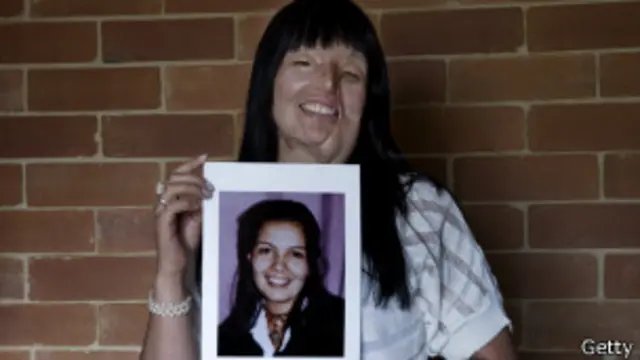 Nubia Espitia con una foto de cómo lucía antes del ataque