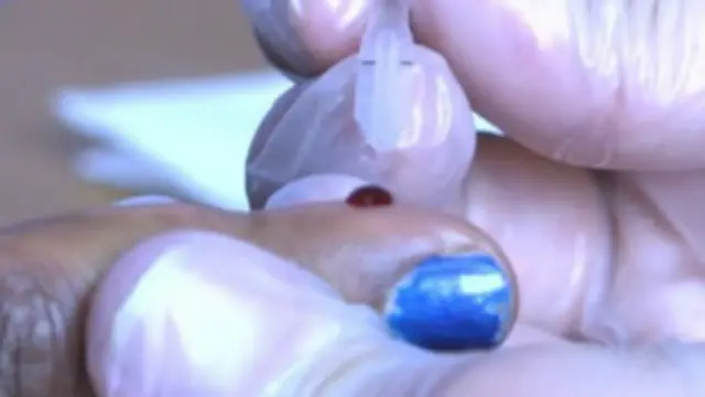 एचआईवी परीक्षण