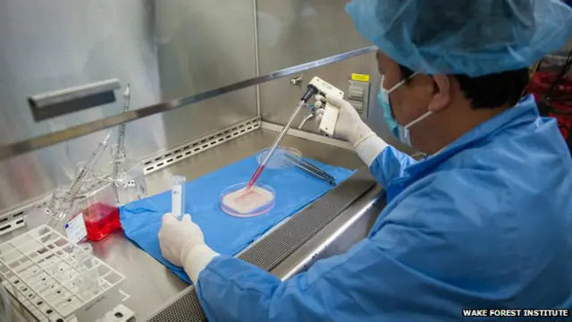 Una parte de la estructura se cubre con células musculares.