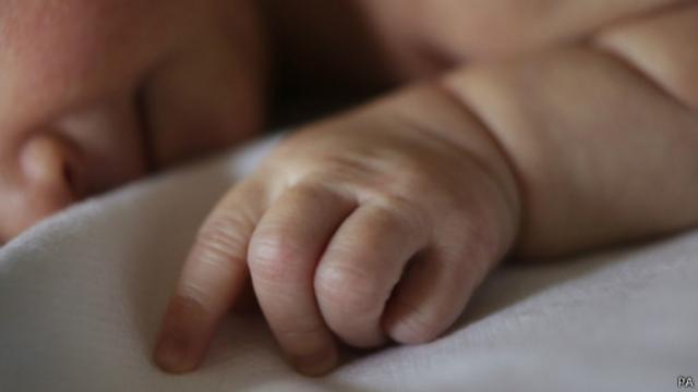 Normal ou cesárea? Conheça riscos, mitos e benefícios de cada tipo de parto  - BBC News Brasil