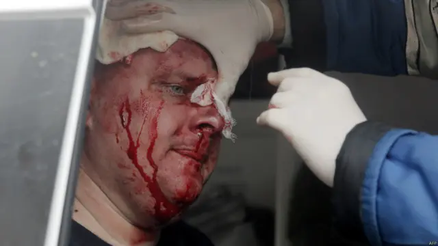 اس سے قبل اتوار کو روس حامی فوجیوں کے ساتھ شہر کے نواحی علاقوں میں جھڑپ کے دوران یوکرین کے کم از کم ایک افسر کے ہلاک ہونے کی اطلاعات ہیں۔