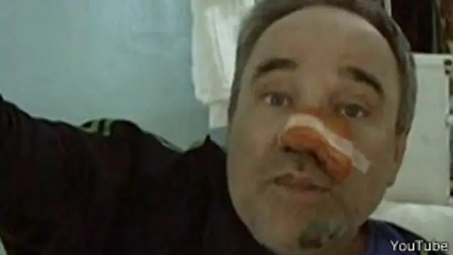 Петхов (Петков) на больничной койке