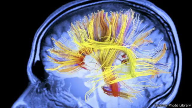 Sel saraf otak, Science Photo Library